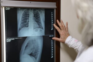Reviewing a chest X-ray